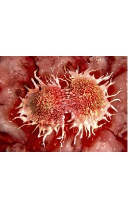 Steroids and Cancer